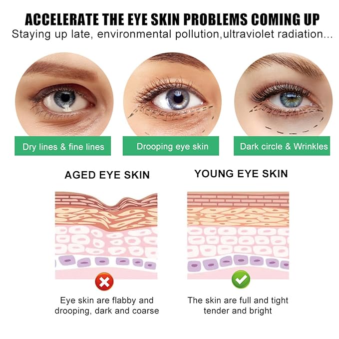 SORYA Caffeine Eye Cream for Dark Circles & Puffiness – Day & Night Under Eye Cream with Niacinamide & Peptides Anti-Aging (1.7 oz)