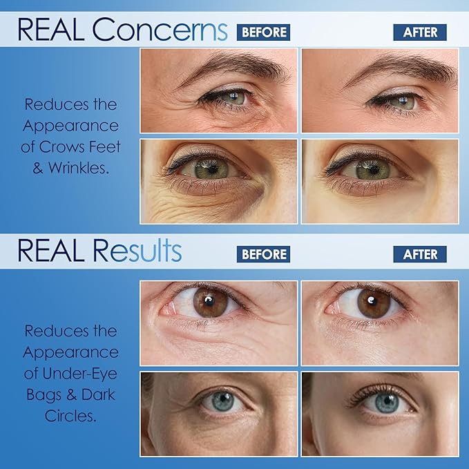 Instant Face Lift Serum, for Under-Eye Bags & Dark Circles, Visible Reduction Serum with Peptide & Collagen, Refines Fine Lines & Crow's Feet
