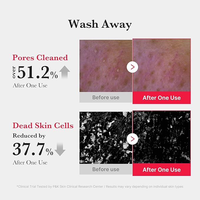 medicube Facial Cleanser Red Foam Cleanser | Daily Gentle Cleansing Foam for Sensitive & Troubled Skin | Deep Cleansing Impurities & Excess Sebum Control | Korean Skincare, 4.23 oz