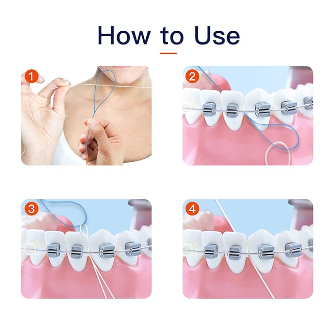 300 Count Floss Threaders for Braces, Bridges, and Implants (6 Packs of 50) - Flexible Nylon Threading Loops - Slim & Durable Dental Floss Helpers for Crowns & Orthodontic Appliances