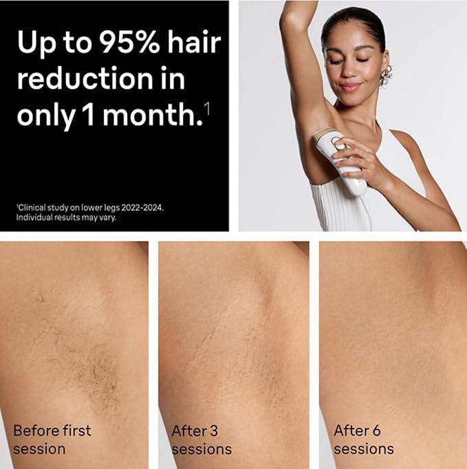Braun IPL Silk·Expert Pro 5 PL5157 Latest Generation IPL, Permanent Visible Hair Reduction, at-Home Hair Removal System with Soft Pouch and Precision Head