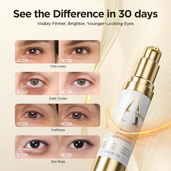 Abarno Hydrating Eye Serum for Dark Circles and Puffiness – Caffeine, Retinol, Niacinamide, Peptides – Anti-Wrinkle, Firming, Smooths Fine Lines – Under Eye Treatment – 0.7 fl. oz
