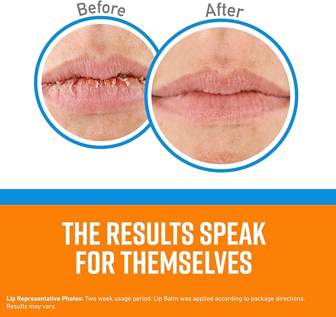 O'Keeffe's Cooling Relief Lip Repair Lip Lips,