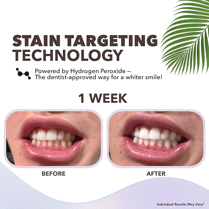 Purli Teeth Whitening Strips 9-Day Treatment – Natural Coconut Oil, Professional Effects, Gum & Enamel Safe, Dry Strip