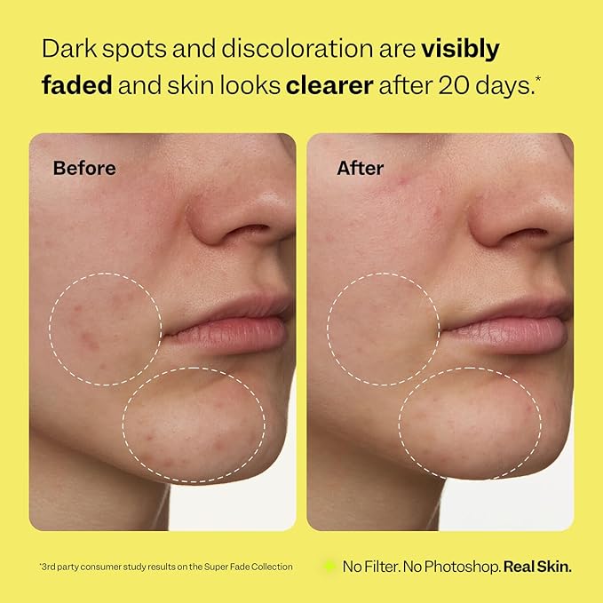 Peach Slices - Super Fade Discoloration Serum for Face (1.01 oz) - Dark Spots, Hyperpigmentation, Uneven Skin - Niacinamide Serum - Tranexamic Acid - Vegan & Cruelty Free - Korean Skin Care & Beauty