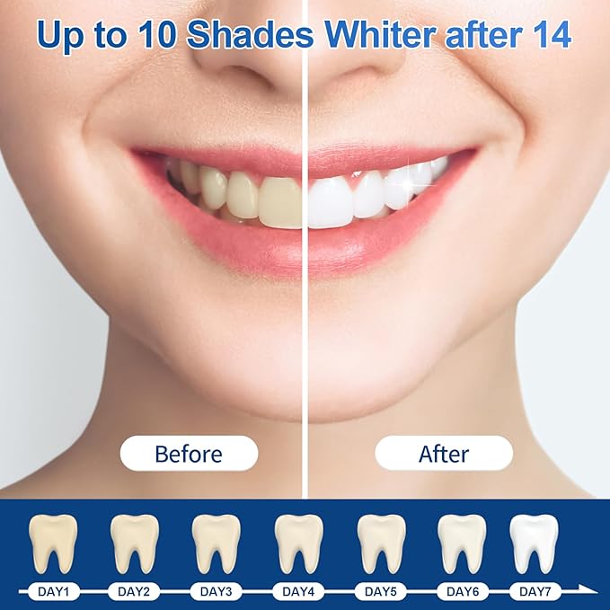 44% Ganencsnc 10 Syringes (3ml) - Teeth Whitening Gel Refills - Strong 44% Carbamide Peroxide Formula - Compatible with Teeth whitening Kit-Teeth Whitener for Coffee & Wine Stains