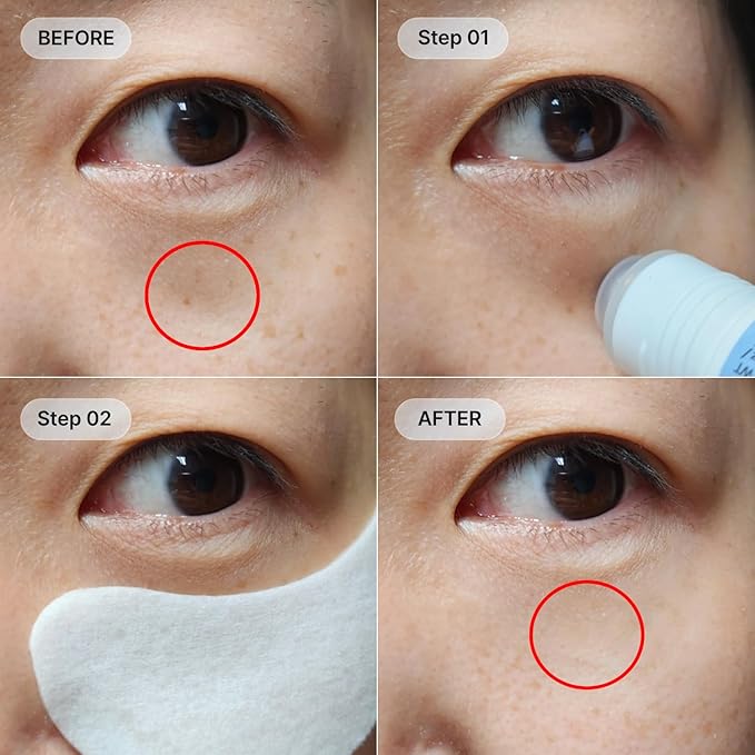 MORENUF Hydrogel Collagen Real Cool 6 Pairs of Eye Patches & Hydrating Roll-On Serum Set for Dark Circles and Puffiness - Hyaluronic Acid and Caffeine Eye Serum Korean