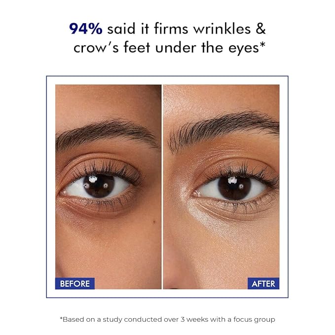 Conscious Chemist® Retinol Peptide Eye Cream with Roller | Under Eye Roll-On for Dark Circles, Puffiness & Fine Lines | Eye Cream for Men & Women | 15ml