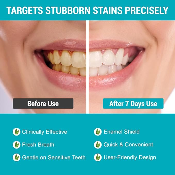 Pap Dry Teeth Whitening Strips 14 Count No Gel Residue Dentist Recommended Sensitivity-Free Formula Enamel Safe Mint Fresh Whitener for Coffee Tea Stains Removal 7 Treatments