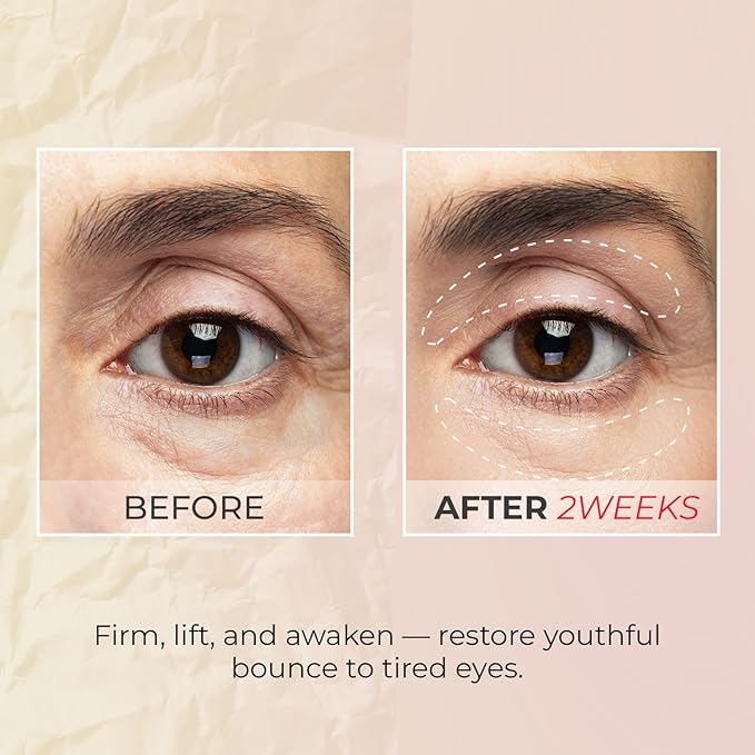 KSBC Look at Me Teen Again Eye Cream, Anti-Aging Line Smoothing Skin Care Treatment, Wrinkle Care, Cruelty Free, for Women and Men 0.84 fl. oz, 25ml