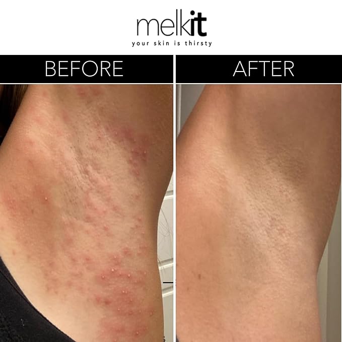 Melkit Body Melk Natural Body Cream - All Over Fast-Absorbing Hydration for Dry or Sensitive Skin - Soothe Sensitive Skin, Rash & Irritation - All Skin Types - 16 oz