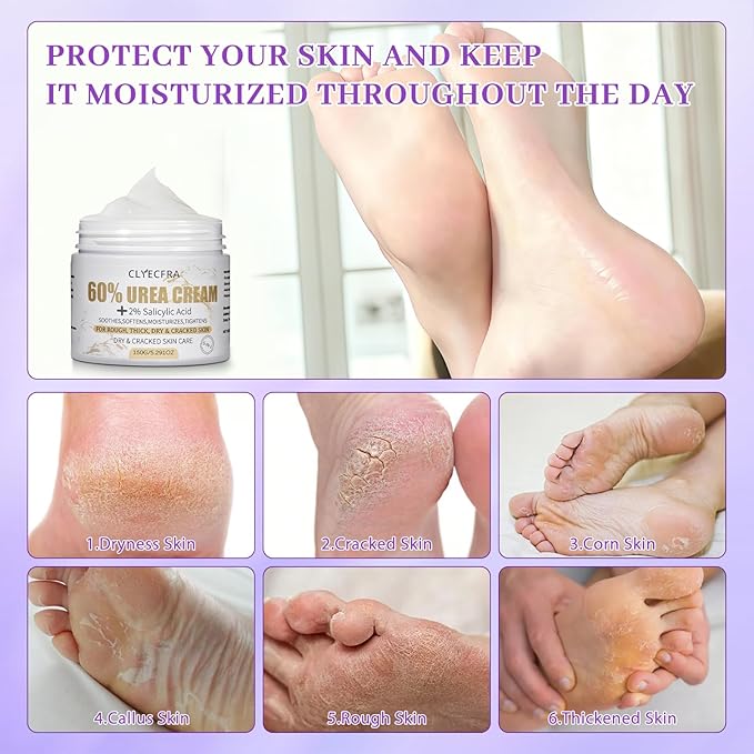 5-in-1 60% Urea Cream with 2% Salicylic Acid, Urea Cream 60 Percent for Feet & Hands- Maximum Strength Moisturizer for Rough, Dry, Thick & Cracked Skin, Callus Remover, Deep Hydration, 150g