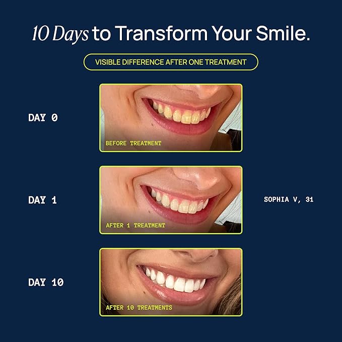Laughland Super Strength to Go Whitening Teeth Pen, Formula with 11% Hydrogen Peroxide, Glycerin, Aloe Vera & Mint, Gentle on Sensitive Teeth, at Home Dental Care, Travel Friendly, 6 Treatments