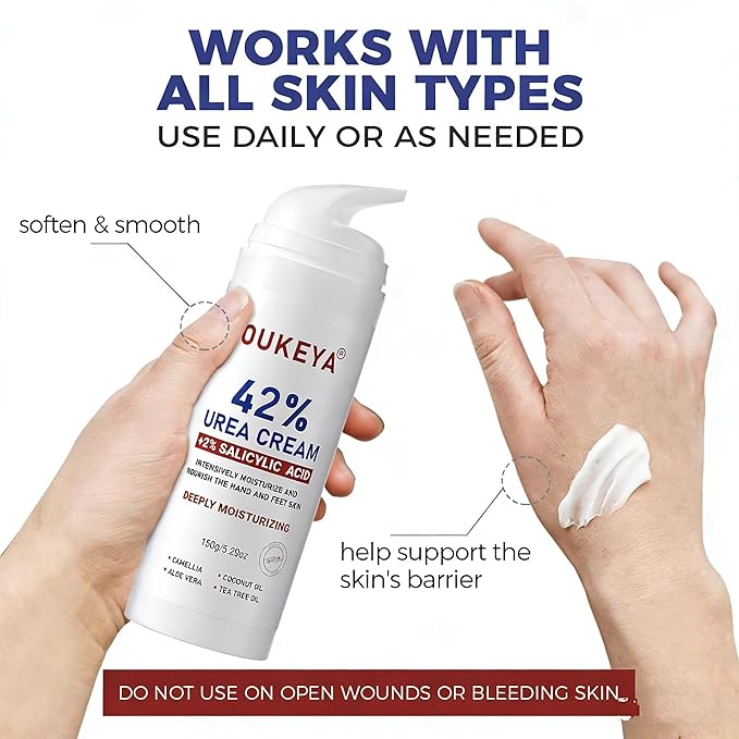 OUKEYA Urea Cream with Salicylic Acid for Dry, Rough Skin – Moisturiser for Feet, Heels, Hands & Elbows, 5.29 Oz