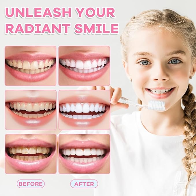 2PC Niacinamide Whitening Toothpaste, Niacinamide Intensive Whiten-ing Toothpaste, Triple Whitening Niacinamides Intensive Toothpastes, Gentle Mint, Fresh Breath, Remove Tooth Stains