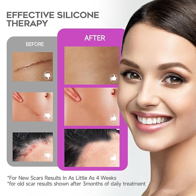 Advanced Scar Cream, 1.7 Oz(50ml) Large