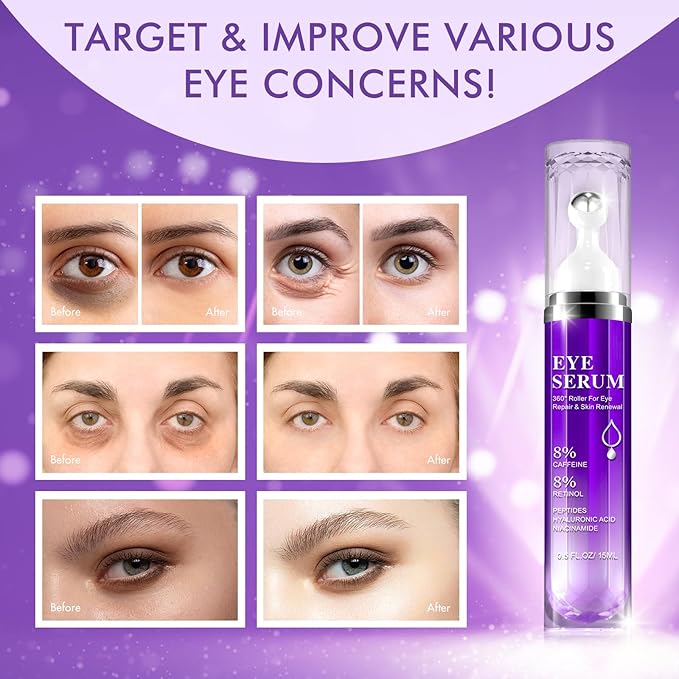Under Eye Roller Serum - 8% Caffeine & 8% Retinol Eye Cream for Dark Circles, Puffiness and Bags, Puffy Bags Fine Lines Wrinkles, 360° Massage Ball Cream, Hyaluronic Acid Serum for Men & Women