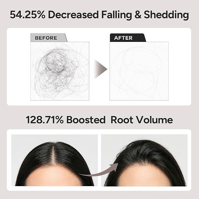 Intensive Tea Tree Scalp Oil Ampoule for Oily, Sensitive Roll-On Applicator – Biotin, Rice Protein & Cica for Balancing Care, Silicone & Sulfate Free, Korean Hair Care – SILICA 3000 | 15 mL