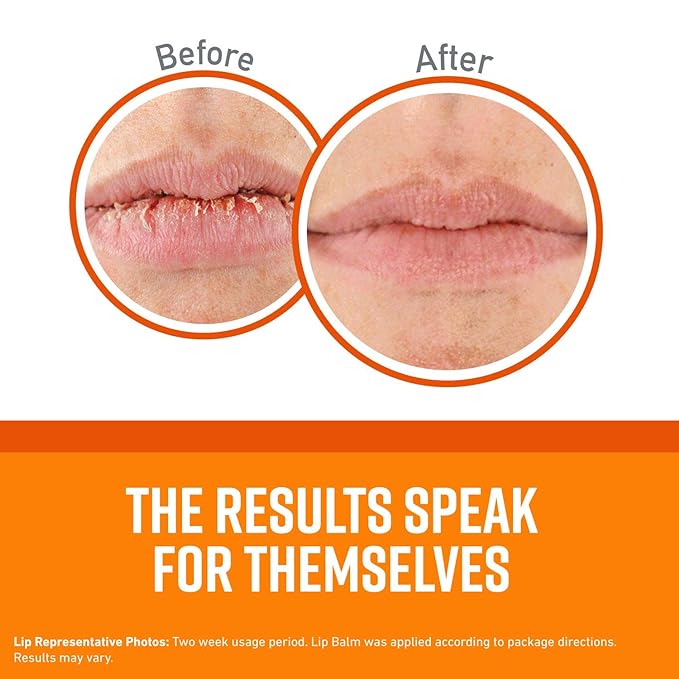 O'Keeffe's Unscented Lip Repair Lip Balm Lips,