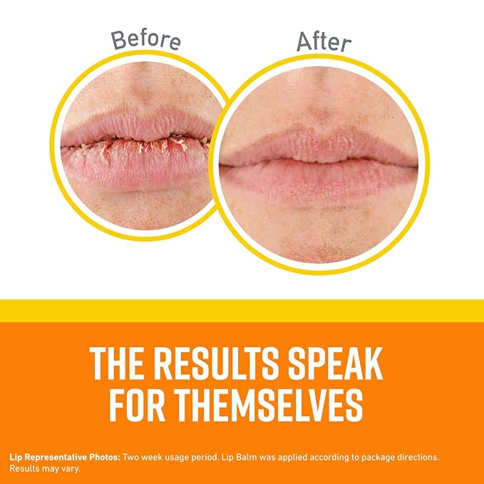 O'Keeffe's Lip Repair SPF 35 Lip