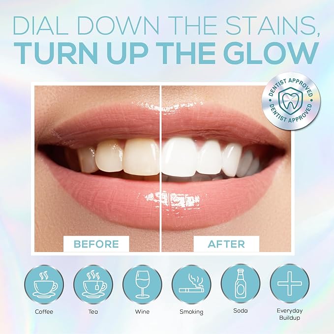 Venus Visage LED Teeth Whitening Kit with 4X 35% Carbamide Peroxide Teeth Whitening Gel Syringes, 2X Remineralization Gel Syringes, Whitener Trays, LED Whitener Device & Shade Guide