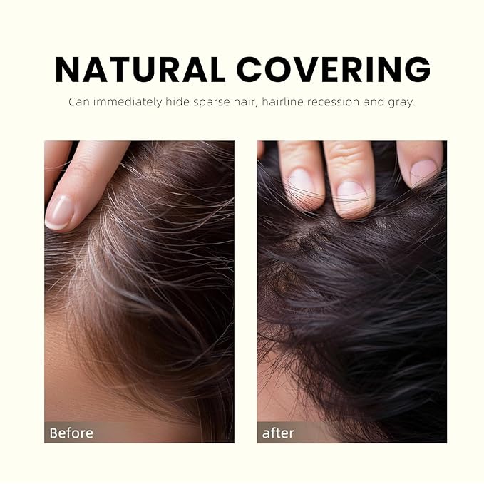 LALACHUU Perfect Mini Hairline Powder, the revolutionary solution for concealing hair loss instantly, Root Touch Up for Women & Men. Stain Proof for 100 hours 0.14 Ounce (Dark Brown)