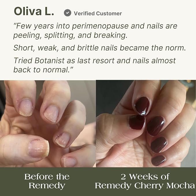 Botanist Nail Rescue Kit | Nail Strengthening Polish + Growth Serum | Grow and Strengthen Damaged Nails | Non-Toxic, 84% Plant Based, 21-Free & Vegan (Cherry Mocha)