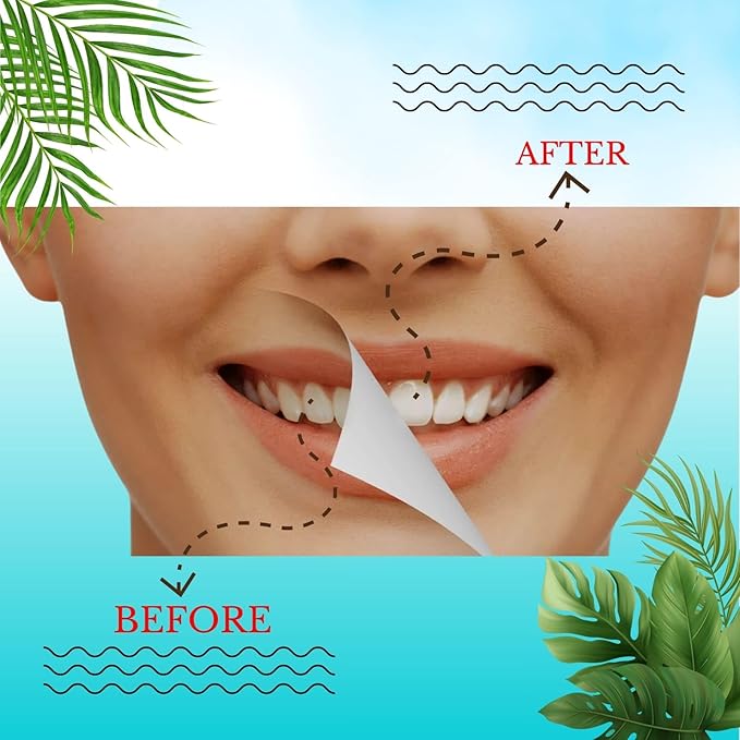 Natural Teeth Whitening Strips for Sensitive Teeth, 42 Strips (21 Treatments), Peroxide-Free & Enamel Safe, Dentist Formulated with Coconut Oil & Dead Sea Salt