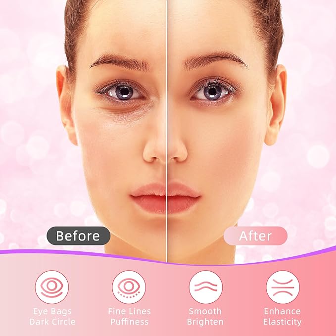 USTELIR Under Eye Patches, 40 Pairs Eye Mask for Dark Circles, Puffy Eyes, Undereye Bags,Wrinkles,Eye Mask Patches with Rose, Eye Treatment Skin Care for Men & Women Gift