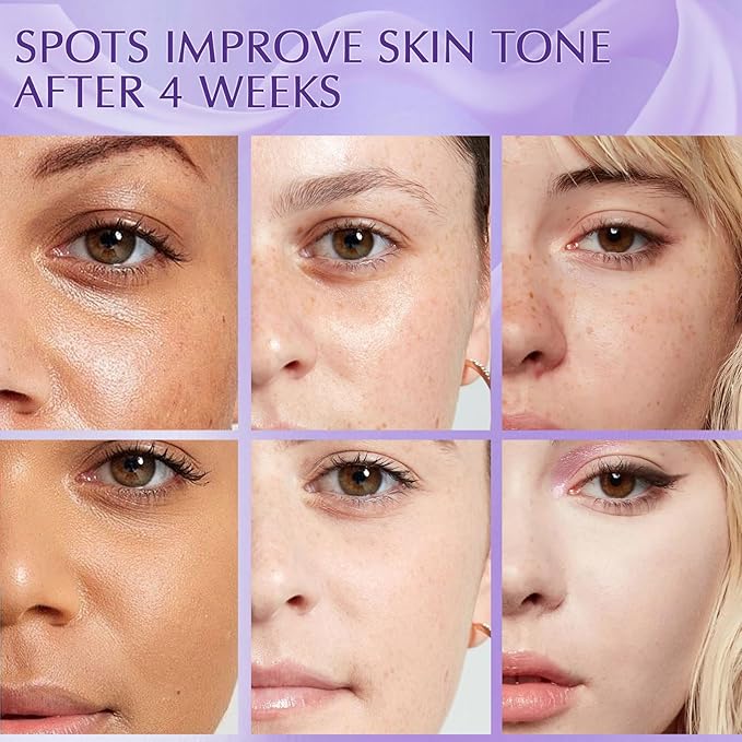 Dark Spot Remover for Face and Body, Dark Spot Corrector, Rapid Tone Repair Retinol Cream, Melasma Treatment with Vitamin C, Upgraded Skin Care Cream for Women Men