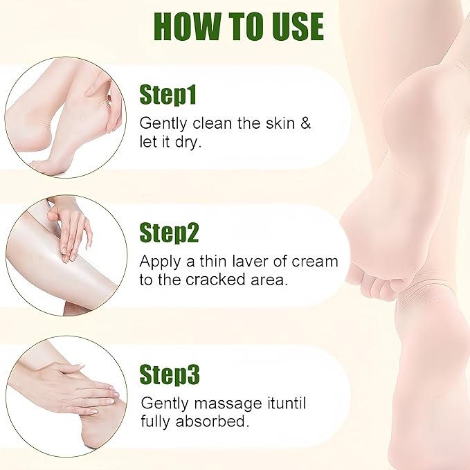 Urea Heel Balm Stick for Feet and Hands,3Pcs Moisturizing Heel Balm for Dry Cracked Feet, Hydrating Stick for Foot & Hands, For Women & Men, Travel Size(Peach, Urea and Honey)