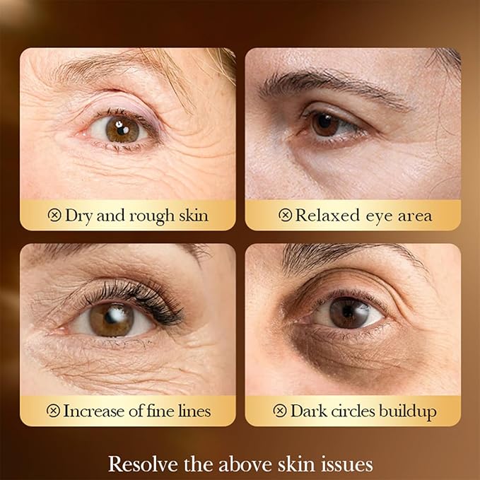 YiJiaBa Under Eye Patches Eye Mask 80 Pieces Extra Strength - Anti-Fatigue Collagen Gel Pads for Dark Circles & Fine Lines | Travel-Friendly Instant Glow