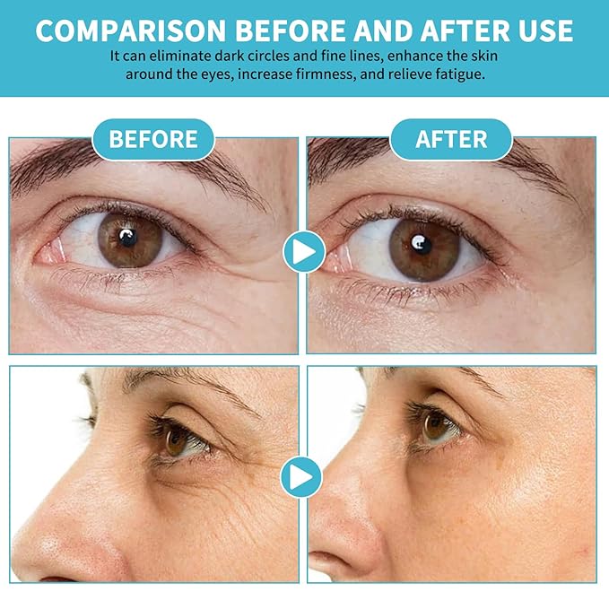 Wrinkles Under Eye Cream with Snail Mucin for Fine Lines Puffiness - Firming Serum Relieve Eye Fatigue for Women