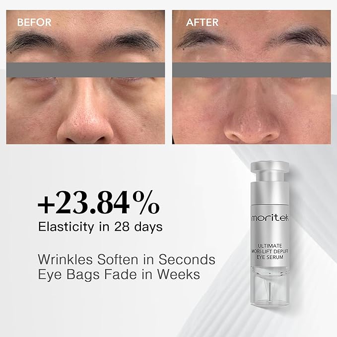 MORITEK Deep Anti-Aging Wrinkle Remover & Eye Serum instantly reduces the appearance of under-eye bags, puffiness, dark circles, wrinkles, fine lines, and crow's feet