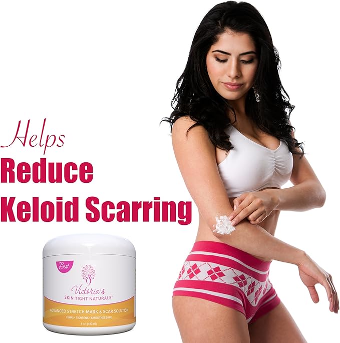 Best Stretch Marks Cream Prevent & Reducing