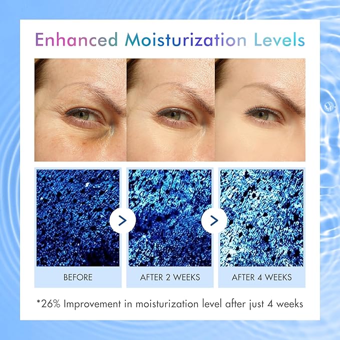 5% Caffeine Eye Serum for Dark Circles & Puffiness, Under Eye Serum with Retinol, Hyaluronic Acid & Niacinamide, Cooling 360° Roller Eye Treatment for Fine Lines, 0.5 fl oz