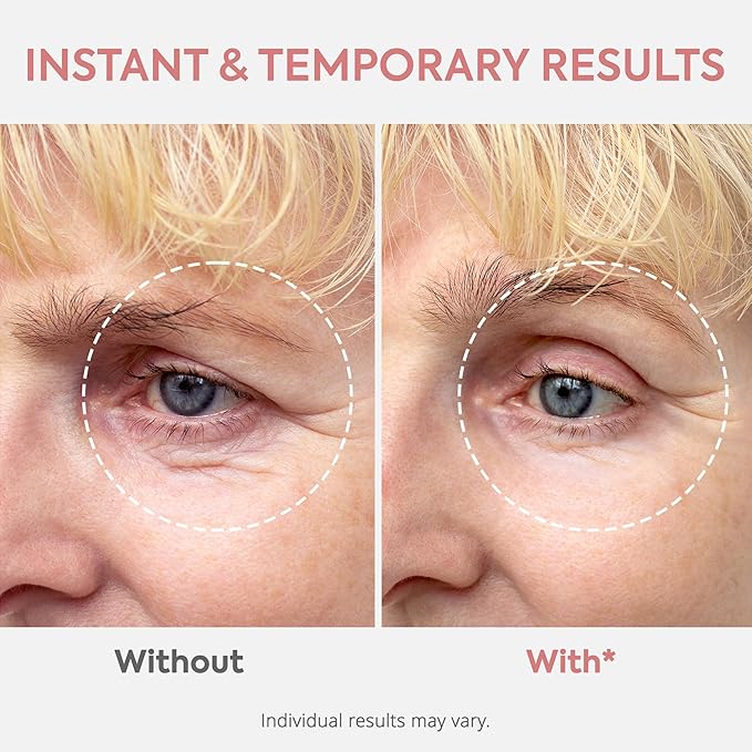 St. Mege Instant Eye & Face Lift Cream: Rapid Under Eye Bags Wrinkle Smile Lines Forehead Lines Remover - Temporary Firming & Tightening Treatment in 2 Minutes, 1 fl. oz.