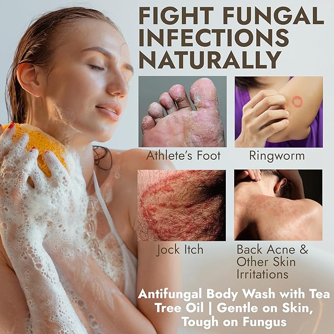 Terramed Just Think Comfort Antifungal Body Wash with Tea Tree Oil | Antifungal Soap Treats Ringworm, Back Acne, Eczema & Jock Itch | Antifungal Body Soap For Men And Women (16.9 oz)