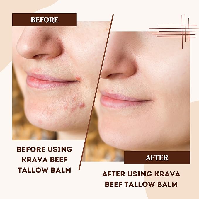 Krava Naturals Beef Tallow for Skin, Beef Tallow for Face, Whipped Tallow Balm, Beef Tallow Moisturizer - Tallow Face Moisturizer, Tallow Cream | 100% Grass Fed, Unscented, 2 oz