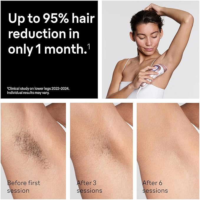 Braun Smart IPL, Skin i·Expert Pro 7: at Home Laser Hair Removal, Permanent Visible Hair Reduction, Vanity Case, Venus Razor, 3 Smart Heads, IPL7243