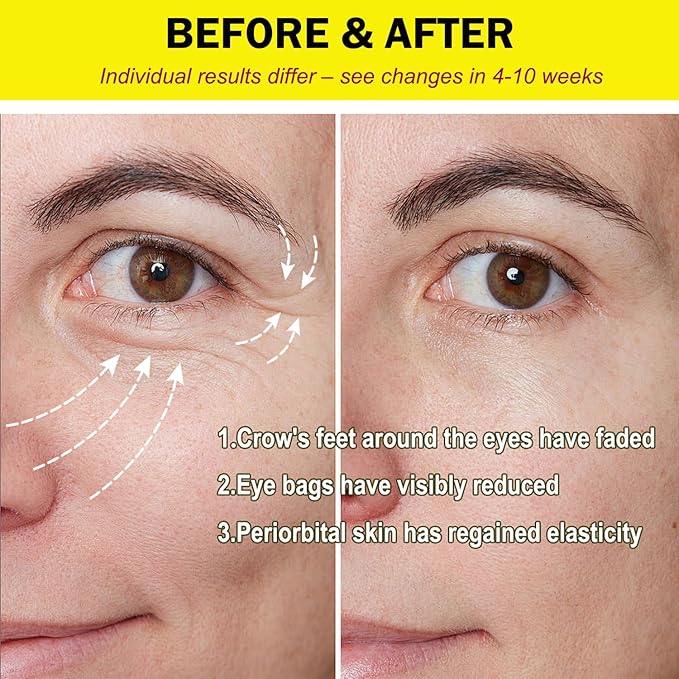 KAZIPA Instant Eye Tightener Cream, Temporary Under Eye Firming & Lifting Cream Anti Aging For Dark Circles,Wrinkles, Fine Lines, Undereye Bags Treatment And Puffiness Removal,1 Fl Oz