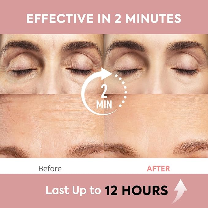 St. Mege Instant Eye & Face Lift Cream: Rapid Under Eye Bags Wrinkle Smile Lines Forehead Lines Remover - Temporary Firming & Tightening Treatment in 2 Minutes, 1 fl. oz.