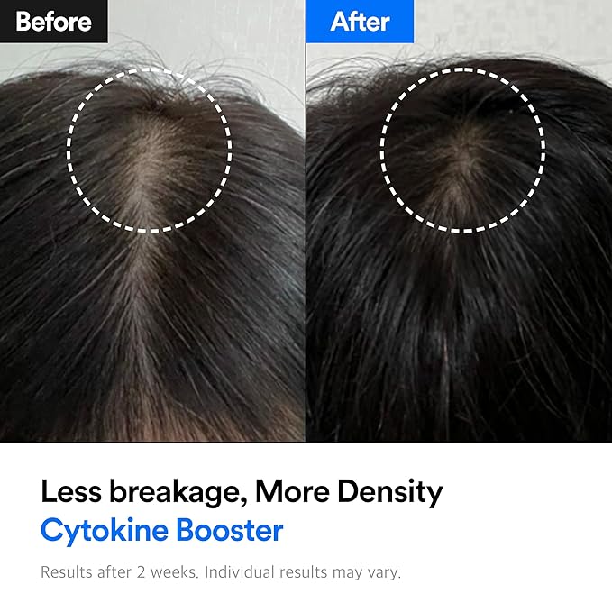 REFILLED Booster Plus Sensitive | Hair Growth Serum & Thickening Scalp Treatment with Built-in Massager for Men & Women | Hair Loss & Thinning |Fuller & Baby Hair Regrowth, Fast-Absorbing with Biotin