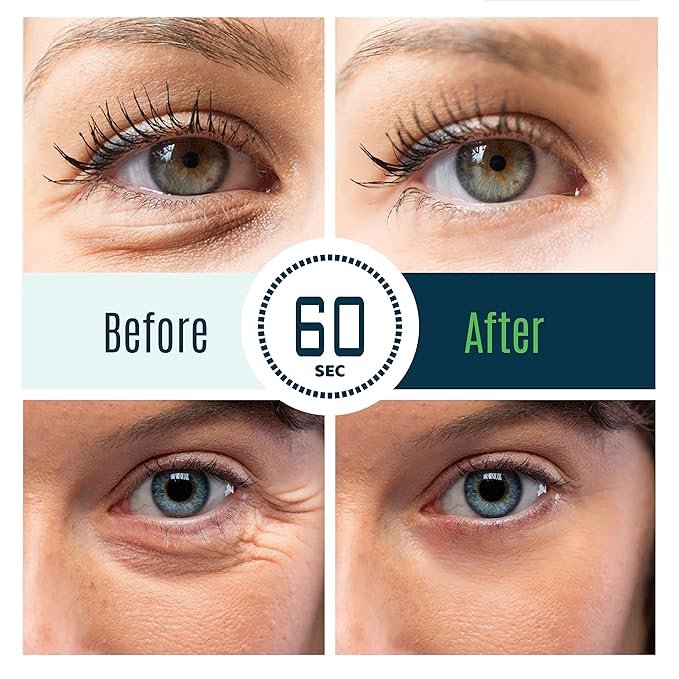 DERMAXGEN Puffy Eye Treatment Time Reverse Instant Anti-aging Eye Cream New Advanced Formula - Visibly Reduce Under-eye Bags, Wrinkles, Dark Circles, Fine Lines & Crow's Feet Instantly - 8ml
