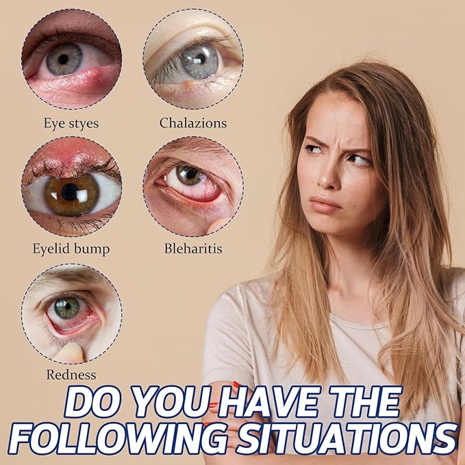 Stye Eye Treatment, Chalazion Treatment Serum, Stye & Blepharitis Remover with Hippophae Rhamnoides Fruit, Helichrysum Angustifolium Flower & Persea Gratissima Oil ((1 Fl. OZ (Pack of 1)))