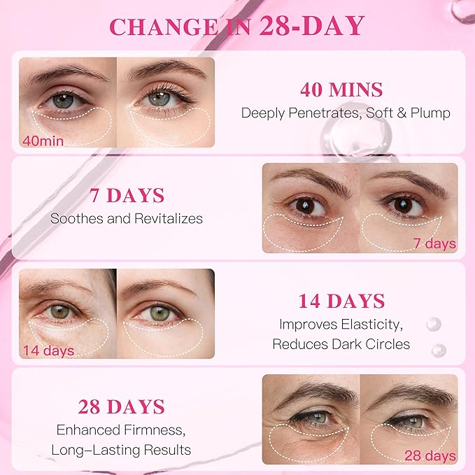ICIKOL Under Eye Patches with Collagen, Eye Patches for Puffy Eyes and Dark Circles, Glowing - Deep Hydrating Hydrogel Eye Mask for Wrinkles, Fine Lines, Gifts for Women - Skin Care, 30 Pairs (White)