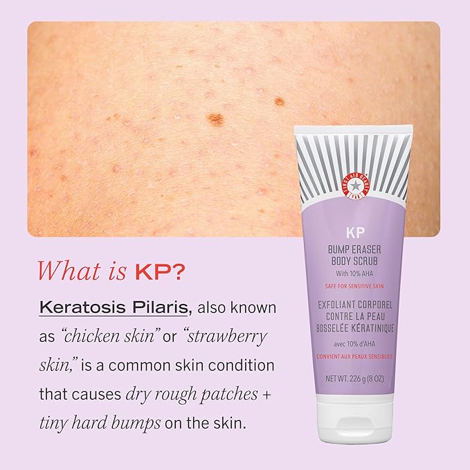 First Aid Beauty KP Bump Eraser Body Scrub 10 oz