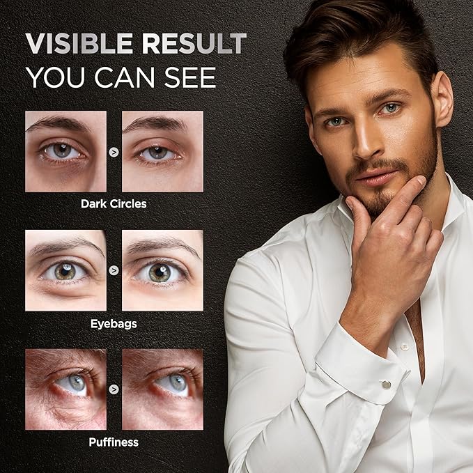 RAZONIX Eye Bags Treatment for Men: Caffeine Eye Roller for Puffy Eyes and Puffiness – Under Eye Cream for Dark Circles (Medium, Unscented)