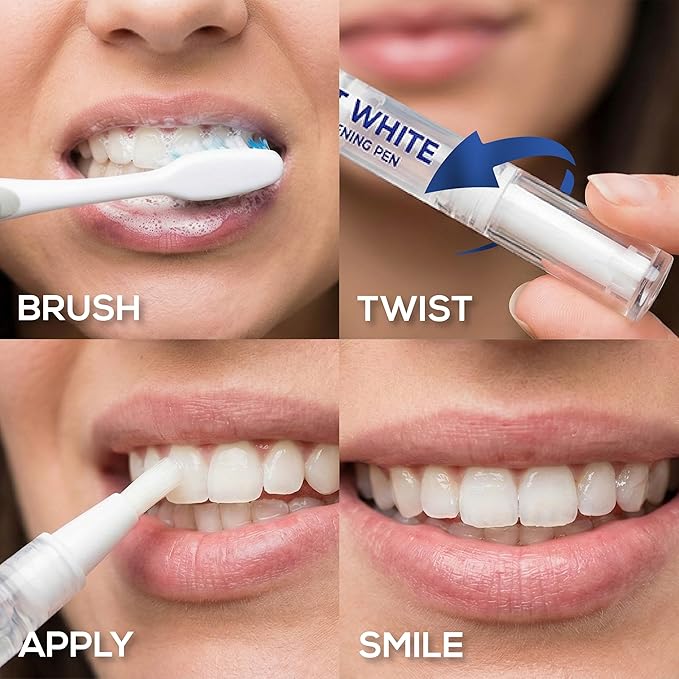 Venus Visage Award Winning Teeth Whitening Pen, 10+ Uses - Teeth whitening Gel Professionally formulated - Best Teeth whitening kit Teeth Whitener - Low Sensitivity - Mint - 0.07 Fl Oz (Pack of 1)