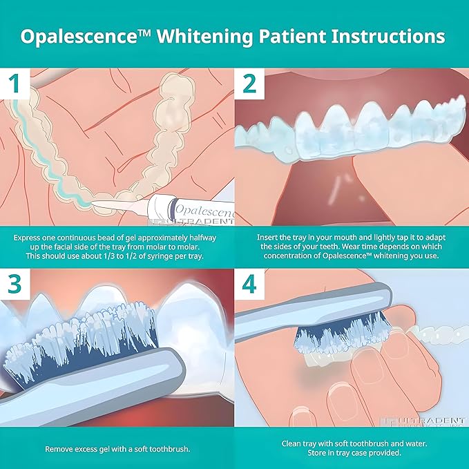 Opalescence 20% Gel Syringes Teeth Whitening - Refill Kit (12 Syringes) Carbamide Peroxide. Made by Ultradent, in Mint Flavor. Tooth Whitening - B-5196-6